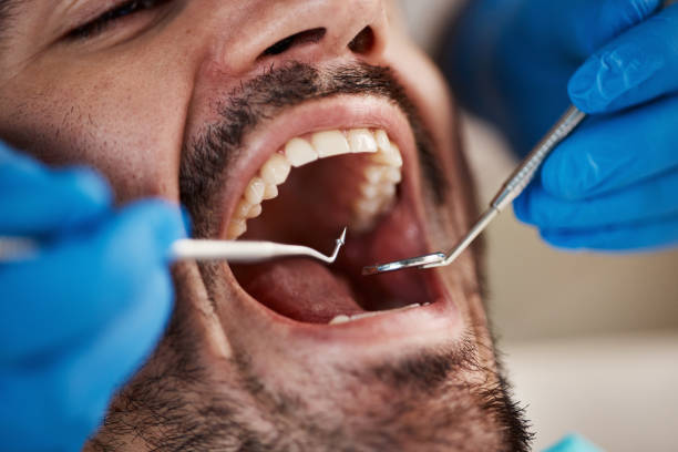 Best Walk-In Emergency Dentist in Fairview, UT